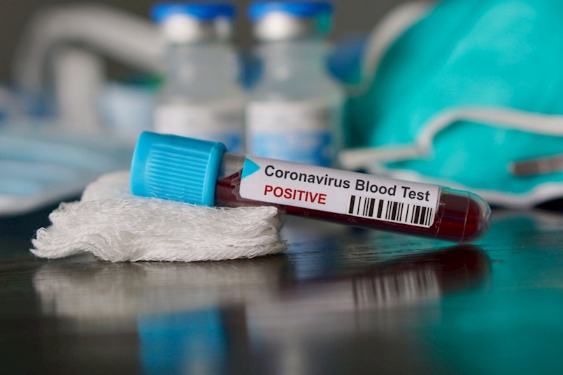 U Istri novih pet osoba ima koronavirus - neslužbeno doznajemo da je jedna osoba iz Labina
