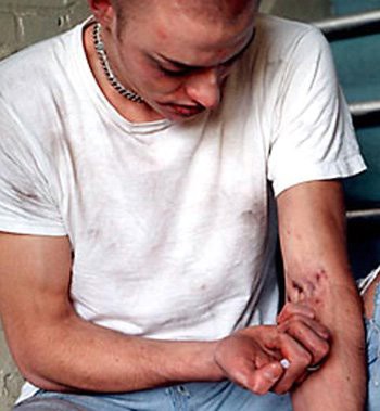 Zabrinjavajuća statistika: U Istarskoj županiji 2009. najviše liječenih ovisnika o drogama