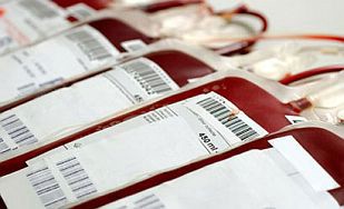 U akcijama dobrovoljnog darivanja krvi u Koromačnu, Potpićnu i Čepiću 58 darivatelja krvi